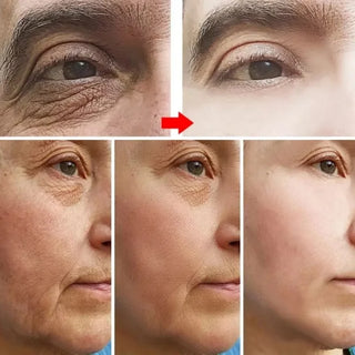  Retinol Anti Aging Face Cream for Wrinkles cashymart