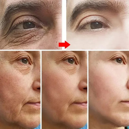  Retinol Anti Aging Face Cream for Wrinkles cashymart
