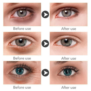  Retinol Anti-aging Whitening Serum cashymart