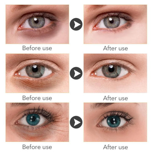  Retinol Anti-aging Whitening Serum cashymart