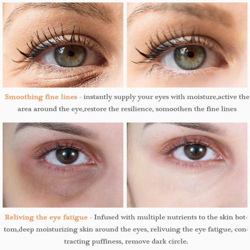  Retinol Anti-aging Whitening Serum cashymart