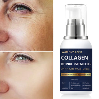  Retinol Moisturising Cream for Dry Skin Nourishment cashymart