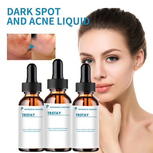  Retinol Serum Anti Wrinkle Facial Serum cashymart