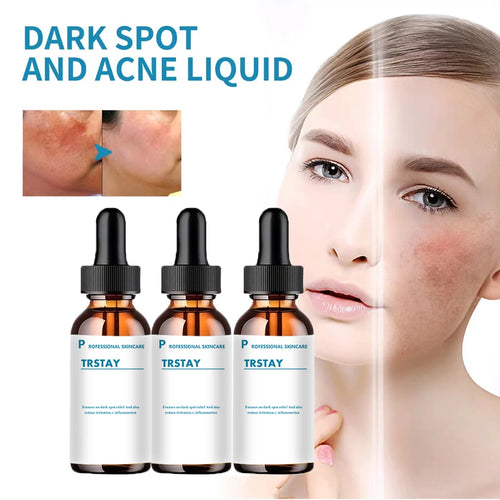  Retinol Serum Anti Wrinkle Facial Serum cashymart