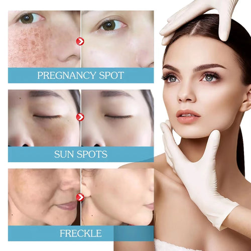  Retinol Serum Anti Wrinkle Facial Serum cashymart