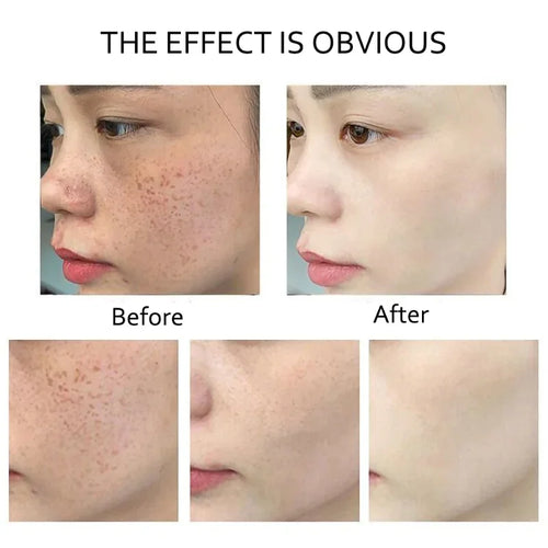  Retinol Serum Anti Wrinkle cashymart