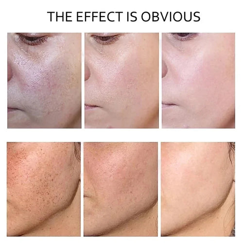  Retinol Serum Anti Wrinkle cashymart