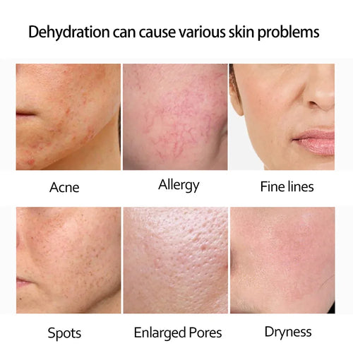  Retinol Serum Anti Wrinkle cashymart