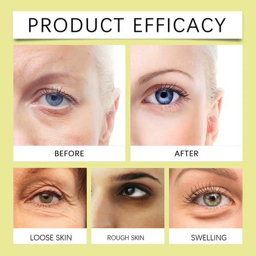 Retinol Shot Tightening Serum cashymart