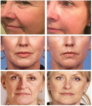  Retinol Wrinkle Remover Face Serum cashymart