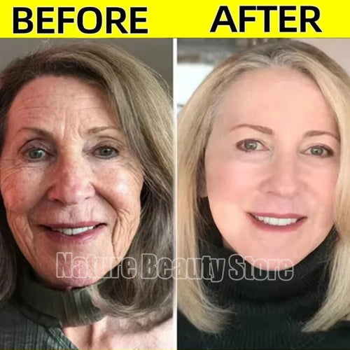  Retinol Wrinkle Remover Face Serum cashymart