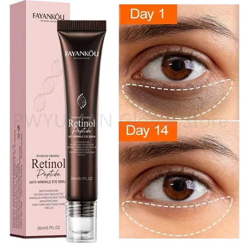  Revitalize Eyes: Retinol Anti-Wrinkle Serum cashymart