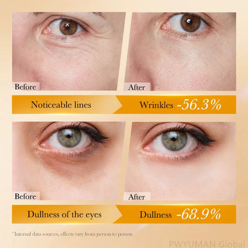  Revitalize Eyes: Retinol Anti-Wrinkle Serum cashymart