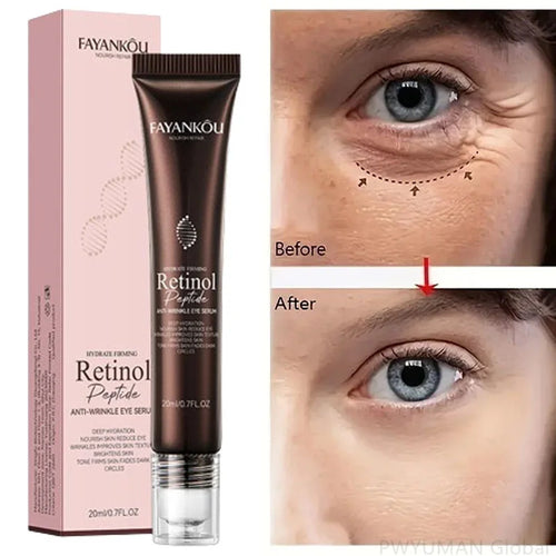  Revitalize Eyes: Retinol Anti-Wrinkle Serum cashymart