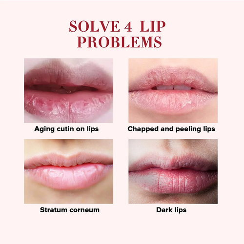  Rose Cherry Honey Lip Mask & Oil cashymart
