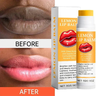  Turmeric Lip Balm cashymart