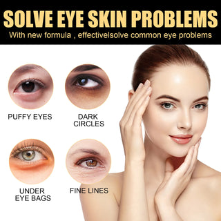  EELHOE Eye Cream Balm for Dark Circles cashymart