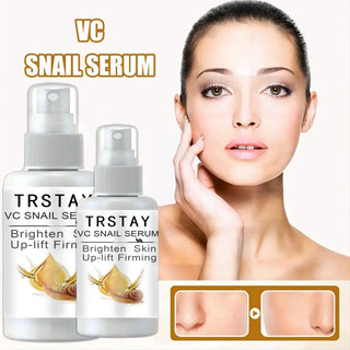 TRSTAY VC Snail Serum