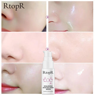  RtopR Anti-Aging Whitening Serum cashymart