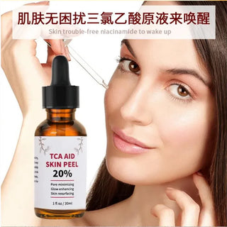  TCA Skin Peel & Pore Minimizer cashymart