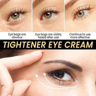  EELHOE Eye Cream Balm for Dark Circles cashymart