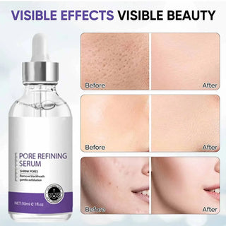  Pore Shrinking Serum for Large Pores and Firm Skin cashymart