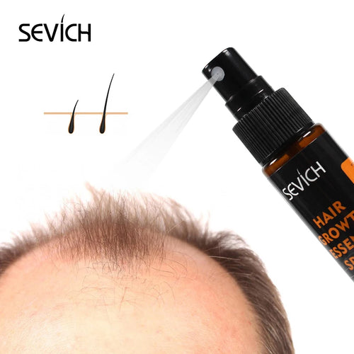  Sevich Hair Growth Essence Spray cashymart