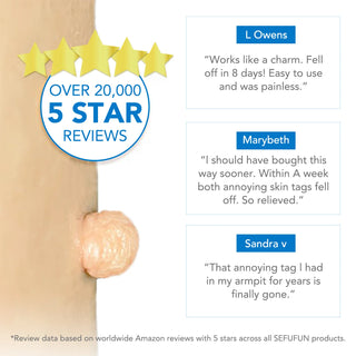  Skin Tag Removal Kit Safe Effective Home Use 2-8mm cashymart
