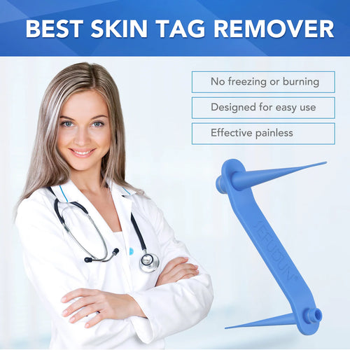  Skin Tag Removal Kit Safe Effective Home Use 2-8mm cashymart