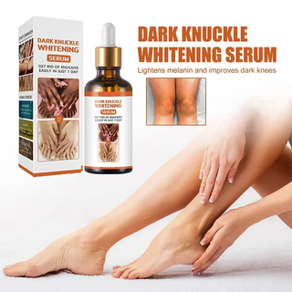  Skin Whitening Cream cashymart