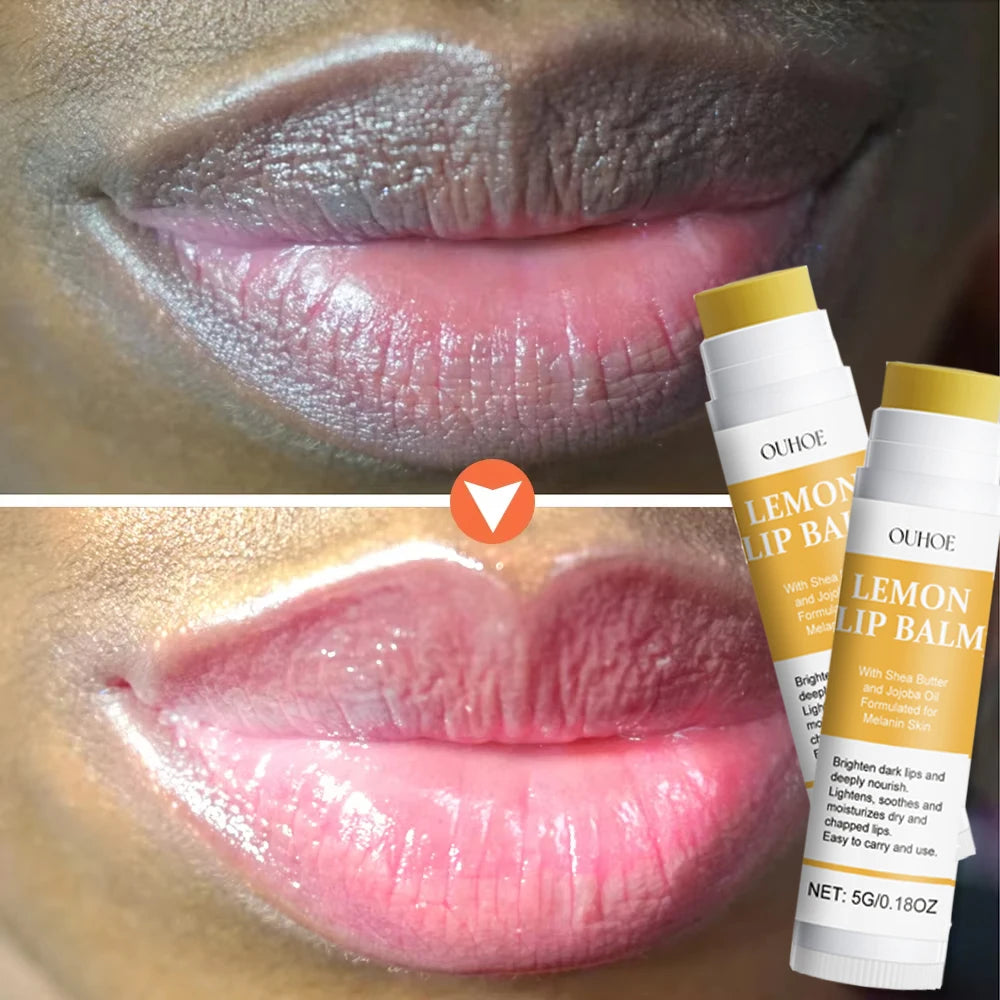 Revitalize Your Lips: Turmeric & Vitamin C Brightening Lip Balm Revitalize Your Lips: Turmeric & Vitamin C Brightening Lip Balm