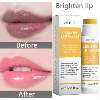 lipo c injections san antonio san antonio lipo c injections Revitalize Your Lips: Turmeric & Vitamin C Brightening Lip Balm lipo c injections san antonio san antonio lipo c injections Revitalize Your Lips: Turmeric & Vitamin C Brightening Lip Balm