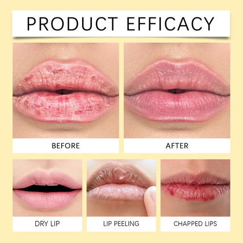  Turmeric & Vitamin C Brightening Lip Balm cashymart