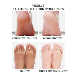  Ultimate Foot Care Pedicure Kit cashymart