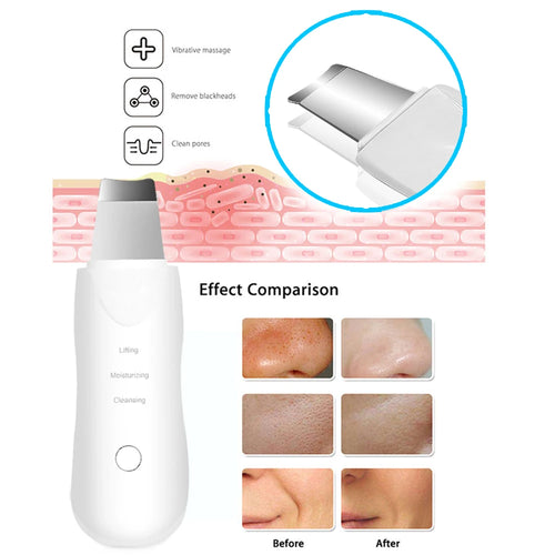  Ultrasonic Skin Scrubber Deep Facial Cleaner cashymart