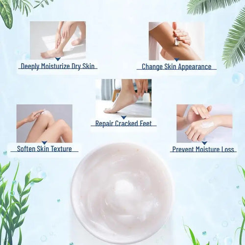  Urea Cream 40% for Hands and Feet 150g cashymart