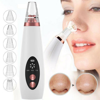  Blackhead Pore Vacuum Cleaner for Acne Removal cashymart