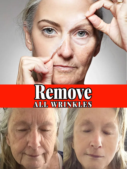  removes wrinkles,anti wrinkle serum cashymart