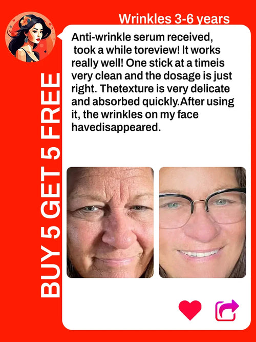  removes wrinkles,anti wrinkle serum cashymart
