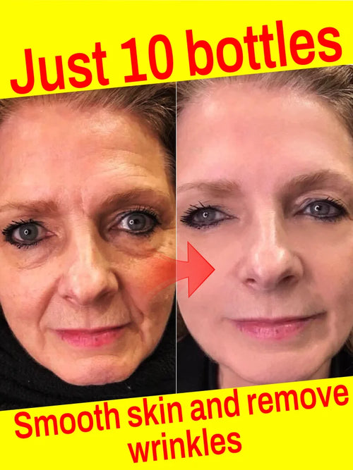  removes wrinkles,anti wrinkle serum cashymart