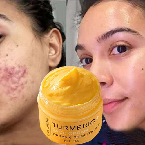  Radiant Glow Turmeric Cream: Clear Skin & Brighten Complexion cashymart